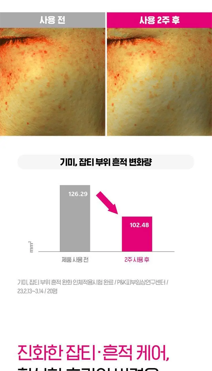 [단독용량] 아이소이 브라이트닝 흔적크림 35ml 상세페이지 9